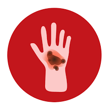 Maybe you would like to learn more about one of these? Alocane Burn Treatment Faq