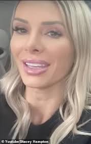 Married At First Sight Stacey Hampton removes her lip fillers for good