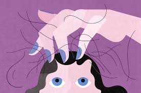 It's typically a general thinning of the hair on the top and sides of the scalp. She Was Losing Fistfuls Of Hair What Was Causing It The New York Times