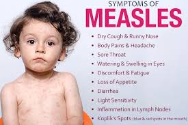 Image result for measles