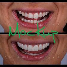 Pin On General Dentistry