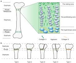 Epiphysis Injury - An Overview | Sciencedirect Topics