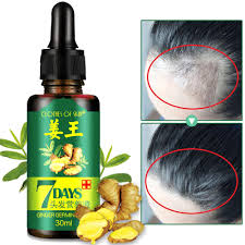 This foam formula is perfect for the early stages of hair loss and is supposed to regrow up to 25 percent more hair. Hot Effective 30ml Bottle Fast Restoration Hair Growth Essence Liquid Natural Ginger Extract Hair Loss Treatment For Women Men Hair Loss Products Aliexpress