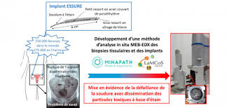 A La Une Ircelyon