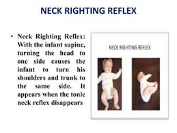 Neonatal Reflexes By Baneet | Ppt
