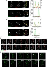 5) why do plant cells possess large sized vacuole ( 2 marks). Er Mitochondria Contacts Promote Mitochondrial Derived Compartment Biogenesis Biorxiv