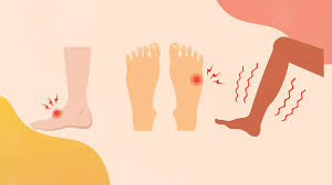 Will it go away on its own? What Is Plantar Fasciitis Symptoms Causes Diagnosis Treatment And Prevention Everyday Health