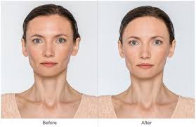 Pin By Sandy Olson On Anti Aging Eye Surgery Plastic Surgeon Skin Care Treatments