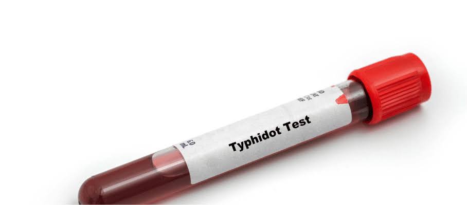 TYPHIDOT IGG & IGM product image