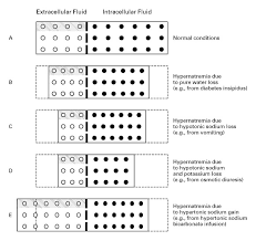 Image result for Hypernatremia