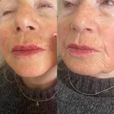 Alexandra Aesthetics Clinic...