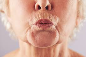 The earlier you start a proper skincare routine the better. Tips On Getting Rid Of Marionette Lines Wellnessbin