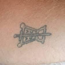 This treatment involves surgically cutting out the keloid. Papamoa Tattoo Removal The Dunes Skin And Laser