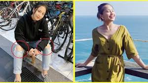 5 maksud mimpi gigi patah 10. Kesian Pakai Seluar Koyak Sebab Duit Habis Beli Penampilan Janna Nick Disindlr Netizen Sebab Nampak Lutut Tube Viral