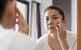 Image result for Body Dysmorphic Disorder