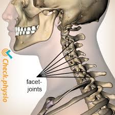 Facet syndrome is back or neck pain that originates from an abnormal spinal facet joints. Cervical Facet Syndrome Physio Check