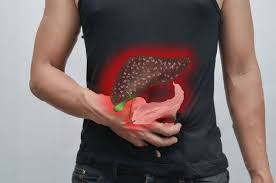 Penyakit batu karang bukanlah sesuatu yang asing di malaysia terutamanya. Gallstone Batu Karang Hempedu Gejala Penyebab Ubat Doctoroncall