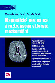 Jedná se o modelové a jediné lůžkové zařízení v čr pro osoby vážně nemocné roztroušenou sklerózou. Magneticka Rezonance A Roztrousena Skleroza Mozkomisni Knihcentrum Cz