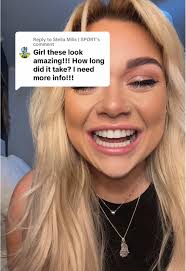 Teeth Transformation Journey with Invisalign