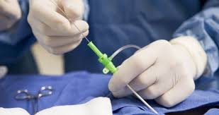 Anjiyo Nedir Neden Yapilir Saglik Haberleri