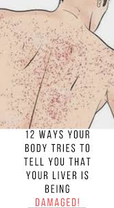 It Is Very Important For A Number Of Bodily Functions Quadrants Of The Abdomen Digestion Problems Abdominal Bloating