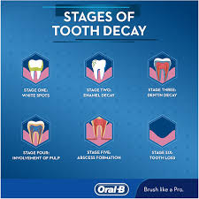 The cells that cure tooth decay. Understanding The Five Stages Of Tooth Decay