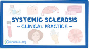 Image result for Systemic Sclerosis