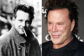 10 Famous Men With Horrible Plastic Surgery Bad Celebrity Plastic Surgery Plastic Surgery Gone Wrong Bad Plastic Surgeries