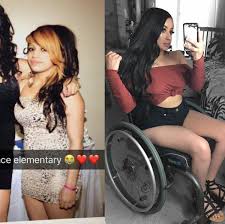 Stunning is the process of rendering animals immobile or unconscious, with or without killing the animal, when or immediately prior to slaughtering them for food. Though This Wheelchair Is Part Of Me It Will Never Define Me Stunning Young Lady Who Was Left A Paraplegic After An Accident
