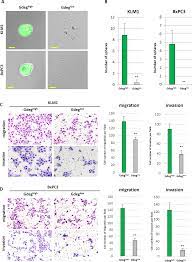 A condition that causes symptoms with your digestion that are not getting better after this may be an urgent referral, usually within 2 weeks, if you have certain symptoms. Plos One Dominant Expression Of Dclk1 In Human Pancreatic Cancer Stem Cells Accelerates Tumor Invasion And Metastasis