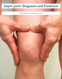 Image result for Septic Joint