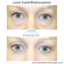 Image result for Blepharis transvaalensis