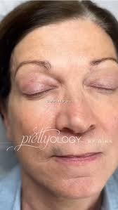 TREAT👏🏻your👏🏻SELF, Call 617 262 1607 or Dm us @prettyology