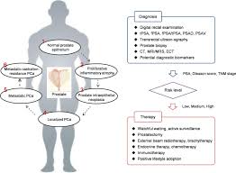 Despite this, pancreatic cancer is among the deadliest types of cancer, which is why it's extremely important to know and recogni. Data Driven Translational Prostate Cancer Research From Biomarker Discovery To Clinical Decision Journal Of Translational Medicine Full Text