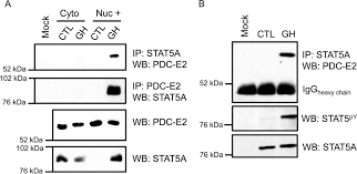 Ym chin & partners menara uoa bangsar. Pyruvate Dehydrogenase Complex Pdc Subunits Moonlight As Interaction Partners Of Phosphorylated Stat5 In Adipocytes And Adipose Tissue Journal Of Biological Chemistry