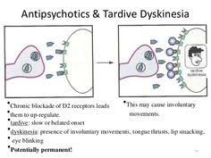 Maybe you would like to learn more about one of these? H Tardive Dyskinesia
