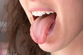 How To Read Your Tongue And What It Says About The State