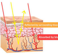 BLZ Tech | How Does Vein Finder Work?