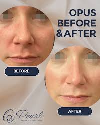 🫱🏻We know the products you should be reaching for! 🫲🏻 Target fine lines  and wrinkles with ZO's Anti-Aging Kit! Get ready to unlock youthful,  radiant skin by using Exfoliating Cleanser, Exfoliating Polish,