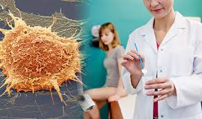 Vaginal bleeding after intercourse, between periods or after menopause watery, bloody vaginal discharge that may be heavy and have a foul odor Cervical Cancer Screening For Signs And Symptoms What Happens If You Miss Your Test Express Co Uk