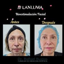 Dr. Rafael Bustos. Clínicas de Medicina Estética (@doctorrafaelbustos) •  Instagram photos and videos