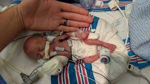 Miracle Baby One Of The Smallest Premature Infants Ever Heads Home Fox31 Denver