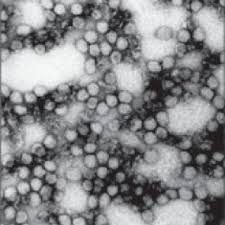 Em 2 de agosto, um homem morreu na guiné contaminado pelo vírus e agora mais de 150 pessoas são monitoradas no país. 1 Virus De Marburg Tomado De Wikipedia Org Wiki Virus De Marburg Download Scientific Diagram