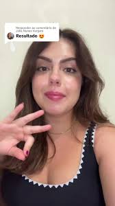 Criolipolise 4 Placas Antes E Depois