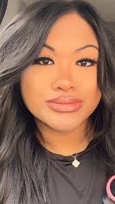 Lips 👄 and filler party !!!!🎉🎊🌸, Russian lips 👄 technique done by Dr  Collins