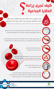 ما هو زرع الخلايا الجذعية المكونة للدم / زرع النخاع العظمي لدى الأطفال؟ تسمى طريقة العلاج هذه زرع نخاع العظم. ÙØ³ØªØ´ÙÙ Ø§ÙÙÙÙ ÙÙØµÙ Ø§ÙØªØ®ØµØµÙ Ø¨Ø§ÙØ±ÙØ§Ø¶ No Twitter Ø£ÙÙØ§ Ø¨Ù Ø²Ø±Ø§Ø¹Ø© Ø§ÙØ®ÙØ§ÙØ§ Ø§ÙØ¬Ø°Ø¹ÙØ© ÙÙØ±Ø¶Ù Ø§ÙØªØµÙØ¨ Ø§ÙÙÙÙØ­Ù ÙÙØ³Øª Ø¹ÙØ§Ø¬ ÙØ¹ØªÙØ¯ Ø­Ø§ÙÙØ§ ÙÙÙ Ø§ÙØ¯Ø±Ø§Ø³Ø§Øª Ø§ÙØ£ÙÙÙØ© Ø¨Ù ÙØª ÙØªØ§Ø¦Ø¬ ÙØ´Ø¬Ø¹Ø© ÙÙØ¹Ø§ÙÙØªÙØ§ ÙÙØ°Ø§ Ø§ÙÙØ±Ø¶ Https T Co Dwcjbqxe5c