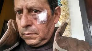 Camarógrafo del gobierno estatal agrede a reportero de San Pedro Cholula •  LADO B