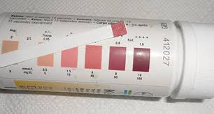 Procedures For Complete Urinalysis Confirmation Testing