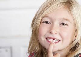 losing first tooth Black Friday Outlet