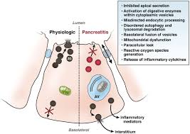 N they are classified into acute and chronic. Models Of Acute And Chronic Pancreatitis Gastroenterology